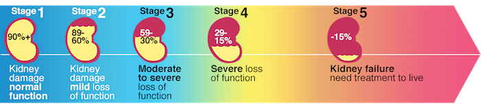 Kidney Failure and Chronic Kidney Disease Stages